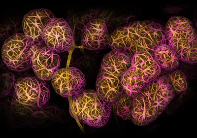 Breast tissue shown in pink and yellow